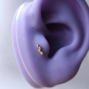 Asimetrik Sıvama Tragus